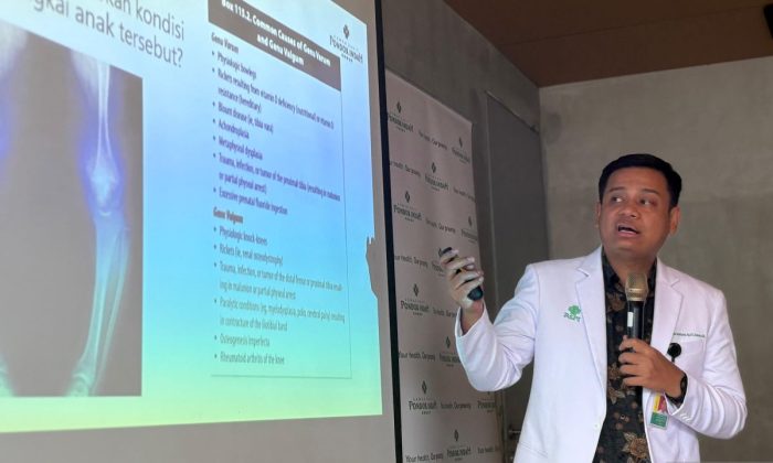 Dokter: Kurang vitamin D penyebab umum kelainan bentuk kaki pada anak