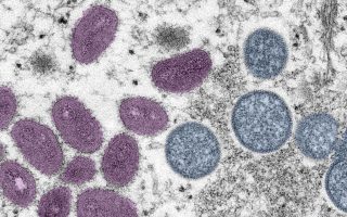 New recombinant mpox strain detected in UK and India, WHO urges continued monitoring