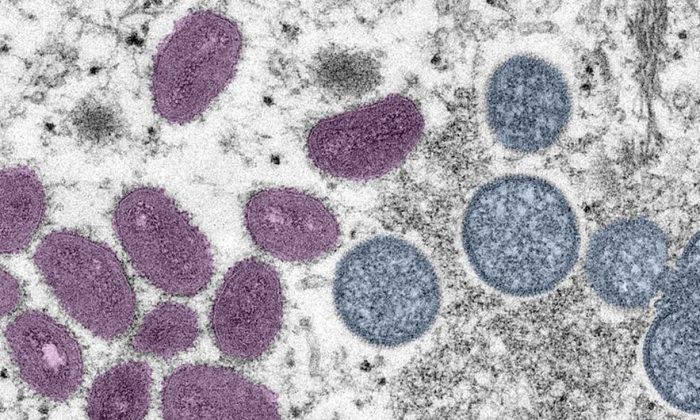 New recombinant mpox strain detected in UK and India, WHO urges continued monitoring