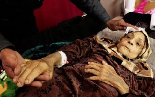 ‘We are dying’: Gaza’s cancer patients plead for a way out