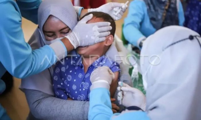 Pakar: Lonjakan kasus campak di RI masih bisa dikendalikan