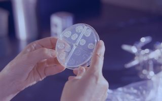 TB Risk Should not Depend on Where We Are Born