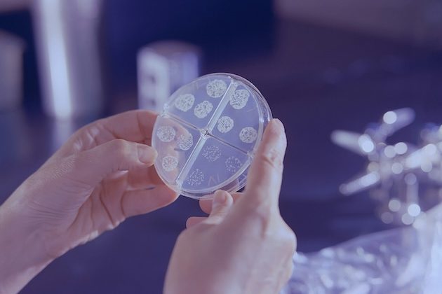 TB Risk Should not Depend on Where We Are Born