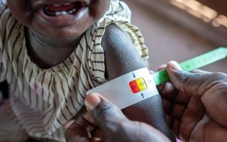 Two-thirds of global hunger concentrated in 10 conflict-hit countries