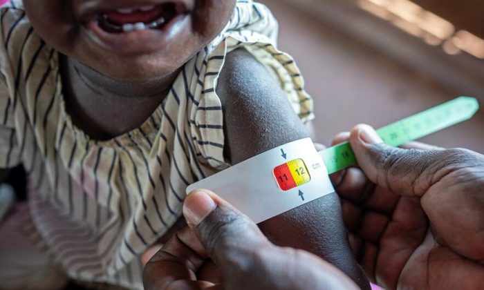 Two-thirds of global hunger concentrated in 10 conflict-hit countries