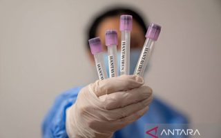 Dinkes sebut suspek hantavirus di Kulon Progo hasilnya negatif