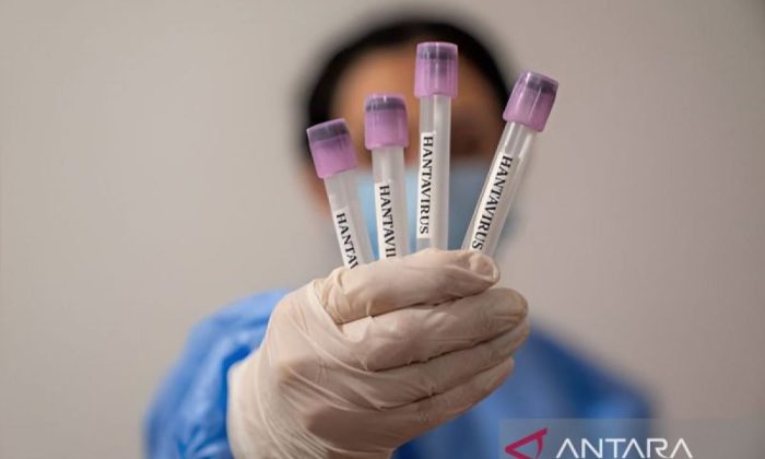 Dinkes sebut suspek hantavirus di Kulon Progo hasilnya negatif
