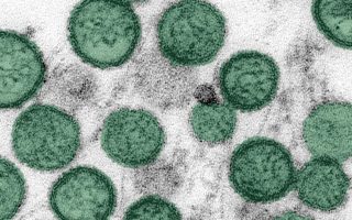 Hantavirus outbreak: Another passenger contracts disease