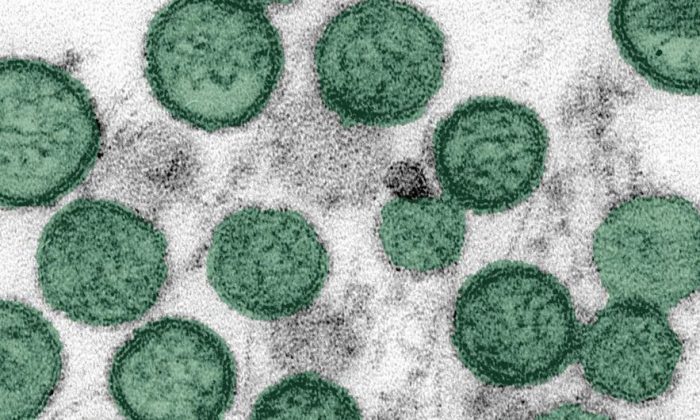 Hantavirus outbreak: Another passenger contracts disease