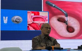 Wapadai tanda-tanda yang mengarah pada masalah katup jantung