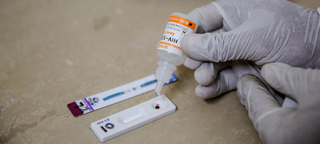 Of 40 Million People Living with HIV today, 32.1 Million are now on Treatment, Living Long & Healthy