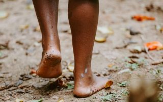 New WHO plan urges stronger action against fungal disease