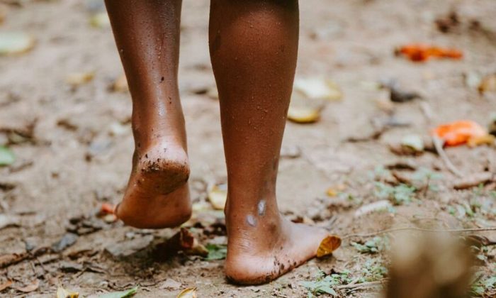 New WHO plan urges stronger action against fungal disease