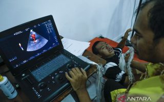 Penyakit rematik jantung bisa sebabkan kebocoran katup jantung