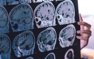 New guidance offers hope for reducing the global toll of dementia
