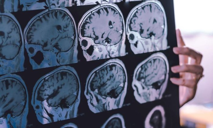 New guidance offers hope for reducing the global toll of dementia